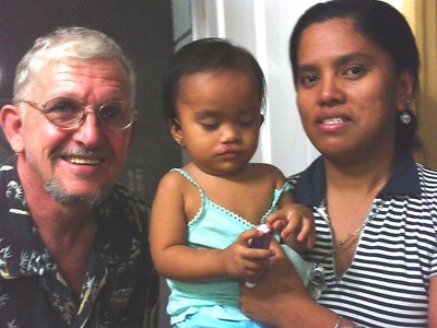 Payatas outreach cleft palate surgery success